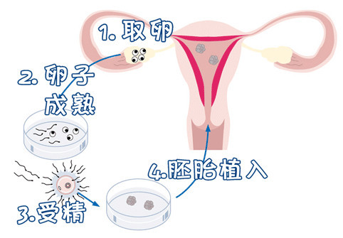 冷冻